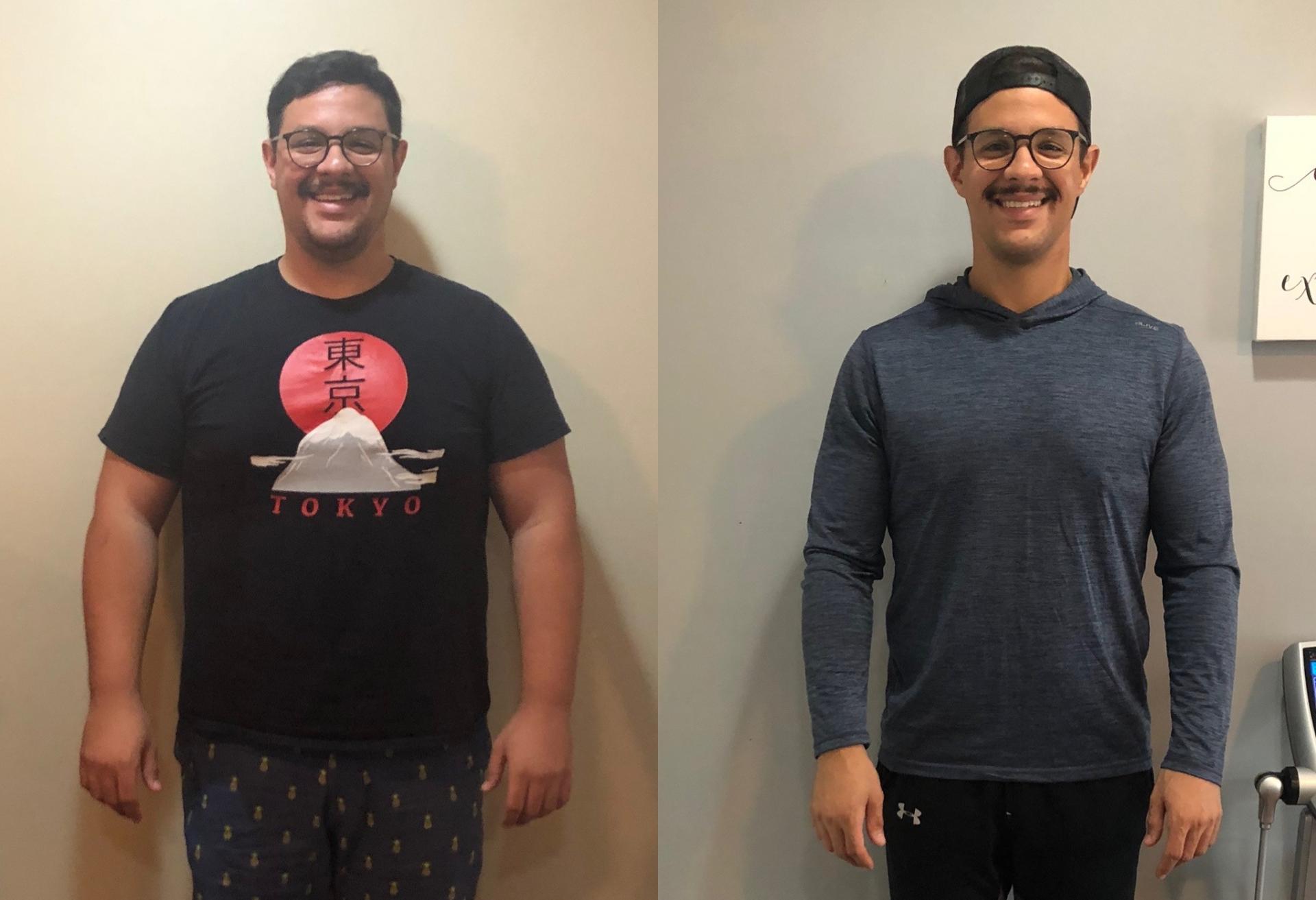 Real Result Medical WeightLoss Kennesaw